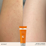 REN Clean Skincare AHA Smart Renewal Body Serum 200ml - Our Concept Beauty